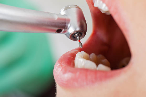 Best Emergency Dentist for Knocked-Out Tooth in Gaston, SC